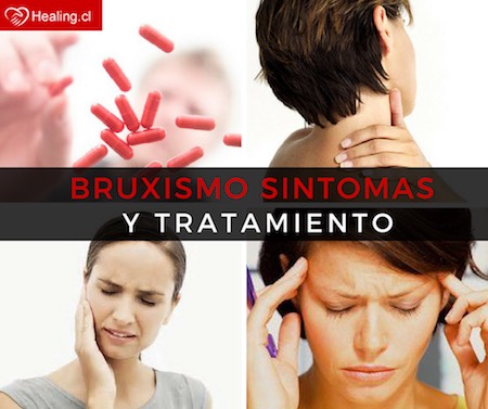 Bruxismo: síntomas, causas y cómo tratar la enfermedad